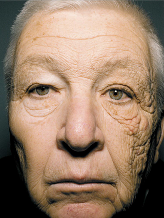 Illustration for article titled Shocking Proof That the Sun Makes You Age Prematurely